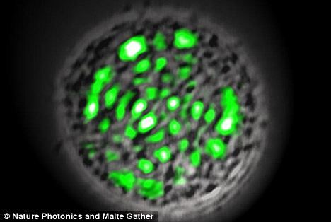 这是显微镜下观察正在产生绿色激光的一个肾脏细胞，这种技术有望在医疗诊断领域发挥重大的作用